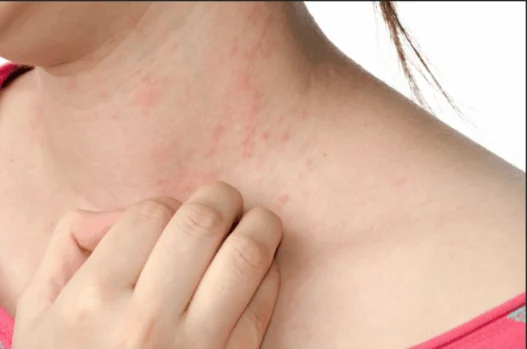 arrivano 285 per alcune malattie autoimmuni