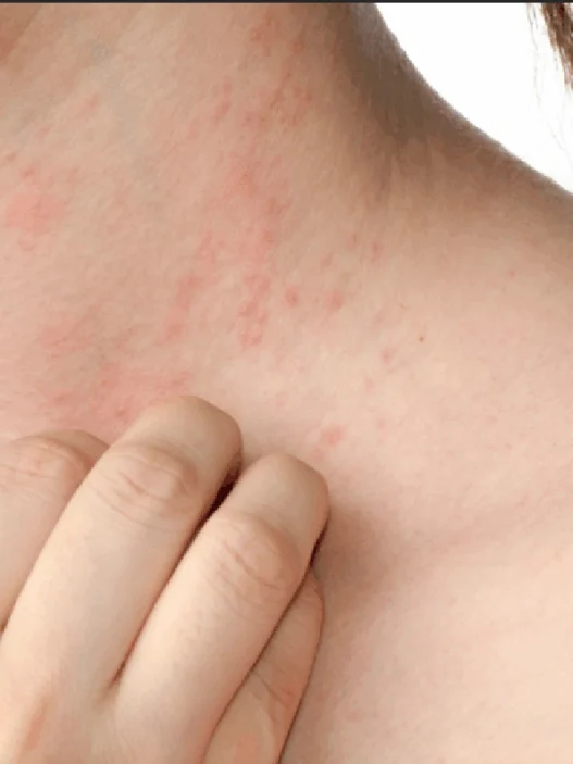 arrivano 285 per alcune malattie autoimmuni