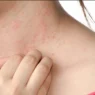 arrivano 285 per alcune malattie autoimmuni