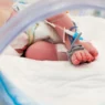 neonati morti prematuri